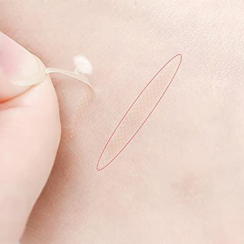 eyelid lifting strips-4